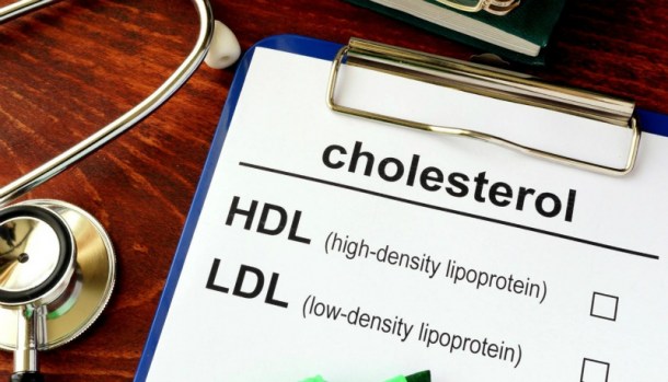 [webinar] „Visoki kolesterol“, 09.10.2020.